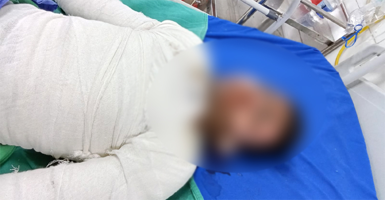 ডেমরায় বাসে আগুন দেয়ায় চালকের সহকারীর মৃত্যু