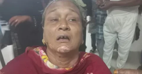 চট্টগ্রামে পেট্রোলবোমা হামলা, দগ্ধ ২