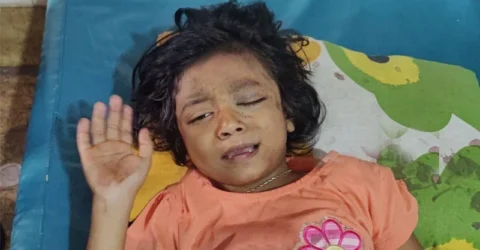 আরাধ্যের শারীরিক অবস্থা উন্নতির দিকে, আজ পায়ে অস্ত্রোপচার
