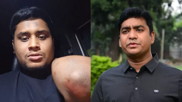 হাসনাতের গড়িতে হামলার ঘটনায় ছাত্রদল সম্পাদক নাছিরের স্ট্যাটাস