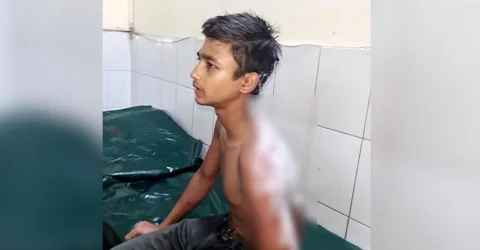 হোটেল কর্মচারীর গায়ে ভাতের গরম মাড় ঢেলে দেওয়ার অভিযোগ