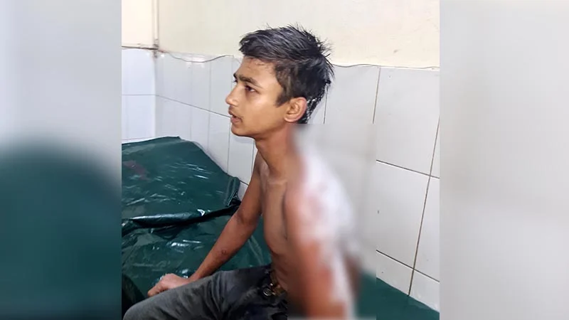 হোটেল কর্মচারীর গায়ে ভাতের গরম মাড় ঢেলে দেওয়ার অভিযোগ